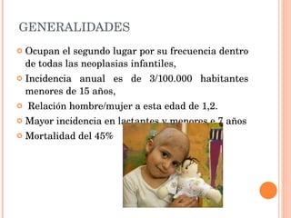 GENERALIDADES Ocupan el segundo lugar por su frecuencia dentro de todas las neoplasias infantiles,  Incidencia anual es de 3/100.000 habitantes menores de 15 años, Relación hombre/mujer a esta edad de 1,2. Mayor incidencia en lactantes y menores e 7 años Mortalidad del 45% 