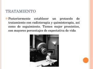 TRATAMIENTO Posteriormente establecer un protocolo de tratamiento con radioterapia y quimioterapia, así como de seguimiento. Tienen mejor pronóstico, con mayores porcentajes de expectativa de vida 