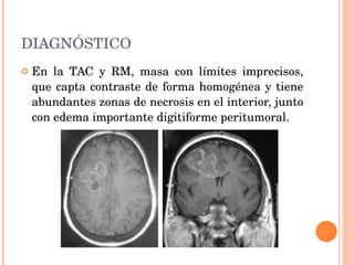 DIAGNÓSTICO En la TAC y RM, masa con límites imprecisos, que capta contraste de forma homogénea y tiene abundantes zonas de necrosis en el interior, junto con edema importante digitiforme peritumoral.  