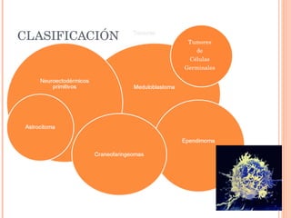 CLASIFICACIÓN Tumores de Células Germinales 