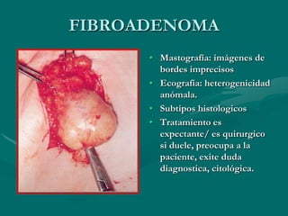 TUMORES MAMARIOS BENIGNOS DE TIPO PARENQUIMATOSOIII ADENOMAPredomina su componente epitelialEs un tumor raro.Mujeres jóvenesSuptipos:  ductal, con cambios de a lactancia, apocrino, pleomórfico, ademoepitelioma, etc.