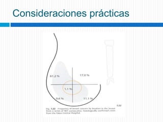 Consideraciones prácticas
 