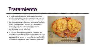• El objetivo fundamental del tratamiento es la
exéresis completa para prevenir la recidiva local.
• Los factores que predisponen la recidiva local son:
resección incompleta, bordes de crecimiento
invasivo y nódulos tumorales secundarios
periféricos al tumor principal.
• El tamaño del tumor primario es un factor de
importancia en el éxito de la resección local, dado
que cuando el tumor es pequeño, es más factible
obtener un margen de seguridad más generoso.
Tratamiento
 
