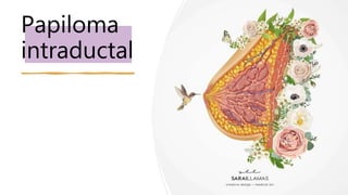 Papiloma
intraductal
 