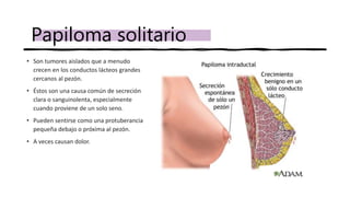 • Son tumores aislados que a menudo
crecen en los conductos lácteos grandes
cercanos al pezón.
• Éstos son una causa común de secreción
clara o sanguinolenta, especialmente
cuando proviene de un solo seno.
• Pueden sentirse como una protuberancia
pequeña debajo o próxima al pezón.
• A veces causan dolor.
Papiloma solitario
 