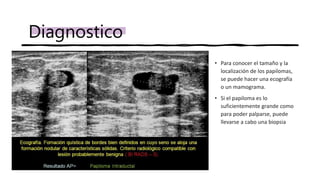 • Para conocer el tamaño y la
localización de los papilomas,
se puede hacer una ecografía
o un mamograma.
• Si el papiloma es lo
suficientemente grande como
para poder palparse, puede
llevarse a cabo una biopsia
Diagnostico
 