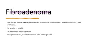 Fibroadenoma
• Macroscópicamente el FA se presenta como un nódulo de forma esférica a veces multilobulada y bien
delimitada.
• Su tamaño es variable
• Su consistencia elástica/gomosa.
• La superficie es lisa, al corte muestra un color blanco grisáceo.
 
