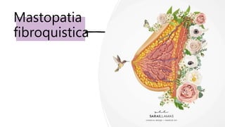 Mastopatia
fibroquistica
 