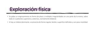 • Se palpa un engrosamiento en forma de placa o múltiples irregularidades en una parte de la mama, sobre
todo en cuadrantes superiores y externos, normalmente bilateral.
• Si hay un nódulo dominante, se presenta de forma regular, borde y superficie definidos y con poca movilidad
Exploración física
 