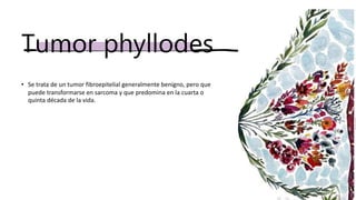 Tumor phyllodes
• Se trata de un tumor fibroepitelial generalmente benigno, pero que
puede transformarse en sarcoma y que predomina en la cuarta o
quinta década de la vida.
 