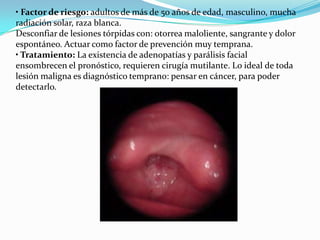 • Factor de riesgo: adultos de más de 50 años de edad, masculino, mucha radiación solar, raza blanca.Desconfiar de lesiones tórpidas con: otorrea maloliente, sangrante y dolor espontáneo. Actuar como factor de prevención muy temprana.• Tratamiento: La existencia de adenopatías y parálisis facial ensombrecen el pronóstico, requieren cirugía mutilante. Lo ideal de toda lesión maligna es diagnóstico temprano: pensar en cáncer, para poder detectarlo. 