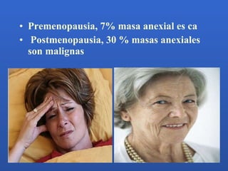 <ul><li>Premenopausia, 7% masa anexial es ca </li></ul><ul><li>Postmenopausia, 30 % masas anexiales son malignas </li></ul>