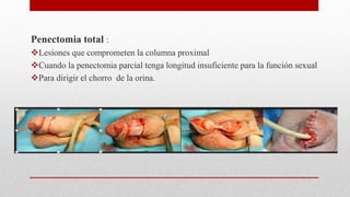 Penectomia total :
Lesiones que comprometen la columna proximal
Cuando la penectomia parcial tenga longitud insuficiente para la función sexual
Para dirigir el chorro de la orina.
 