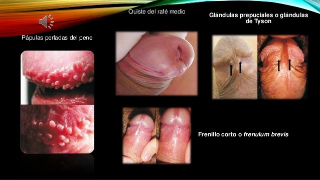 A nosotros era por primera vez y a él el pequeño miembro