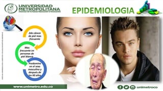 2do cáncer
de piel mas
frecuente
Mas
frecuente en
personas de
piel blanca
Predomina
en el sexo
masculino y
después de
los 60 años
 