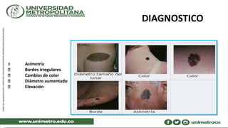 DIAGNOSTICO
Asimetría
Bordes irregulares
Cambios de color
Diámetro aumentado
Elevación
 
