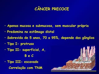 CÂNCER PRECOCE



• Apenas mucosa e submucosa, sem muscular própria
• Predomina no estômago distal
• Sobrevida de 5 anos, 70 a 95%, depende dos gânglios
• Tipo I- protruso
                                 1
• Tipo II- superficial, A,
            B e C
                             2
• Tipo III- escavado         3

  Correlação com TNM
 