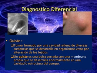 Diagnostico Diferencial Quiste : Tumor formado por una cavidad rellena de diversas sustancias que se desarrolla en organismos vivos por alteración de los tejidos Un  quiste  es una bolsa cerrada con una  membrana  propia que se desarrolla anormalmente en una cavidad o estructura del cuerpo.  