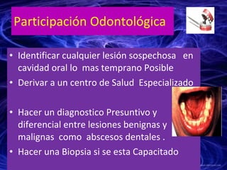 Participación Odontológica <ul><li>Identificar cualquier lesión sospechosa  en cavidad oral lo  mas temprano Posible </li>...