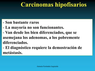 Antonio Ferrández Izquierdo
Carcinomas hipofisarios
- Son bastante raros
- La mayoría no son funcionantes.
- Van desde los bien diferenciados, que se
asemejana los adenomas, a los pobremente
diferenciados.
- El diagnóstico requiere la demostración de
metástasis.
 