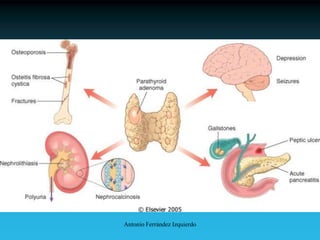 Antonio Ferrández Izquierdo
 