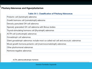 Antonio Ferrández Izquierdo
 