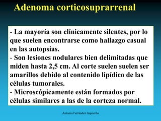 Antonio Ferrández Izquierdo
Adenoma corticosuprarrenal
- La mayoría son clínicamente silentes, por lo
que suelen encontrarse como hallazgo casual
en las autopsias.
- Son lesiones nodulares bien delimitadas que
miden hasta 2,5 cm. Al corte suelen suelen ser
amarillos debido al contenido lipídico de las
células tumorales.
- Microscópicamente están formados por
células similares a las de la corteza normal.
 