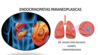 ENDOCRINOPATIAS PARANEOPLASICAS
DR. JHILDO LENIS PACHECO
UDABOL
ENDOCRINOLOGIA
 