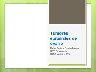 Tumores
epiteliales de
ovario
Rafael Enrique Carrillo Baylón
HGT, Ginecología
UABC Medicina 2016
 