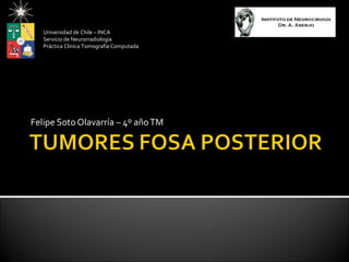 Universidad de Chile – INCA
   Servicio de Neurorradiología
   Práctica Clínica Tomografía Computada




Felipe Soto Olavarría – 4º año TM
 