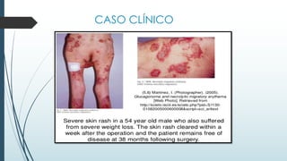 CASO CLÍNICO
 