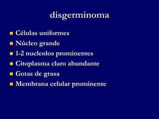 disgerminoma
 Células uniformes
 Núcleo grande
 1-2 nucleolos prominentes
 Citoplasma claro abundante
 Gotas de grasa
 Membrana celular prominente
 