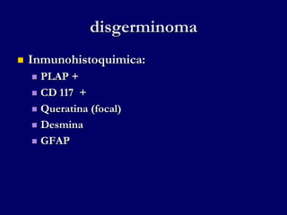 disgerminoma
 Inmunohistoquimica:
 PLAP +
 CD 117 +
 Queratina (focal)
 Desmina
 GFAP
 