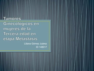 Liliana Gómez Juárez
ID 148017

 