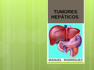 TUMORES HEPÁTICOS  MANUEL  RODRÍGUEZ 