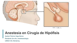 1
Anestesia en Cirugía de Hipófisis
Asahari Palmira Vega Alonzo
Residente 3er año, anestesesiología
UMAE # 25, Monterrey.
 