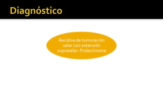 Sindrome de disfunsionHipotalamo- hipofisisSindromequiasmatico