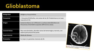       La TAC es superior para ver vascularidad (meningiomas, metástasis, gliomas, malformaciones arteriovenosa) que pueden confundirse con un tumor.