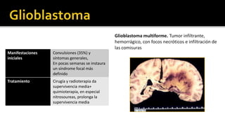        Es mejor en etapa aguda para ver si hay sangrado dentro del tumor, (apoplejía pituitaria o metástasis)