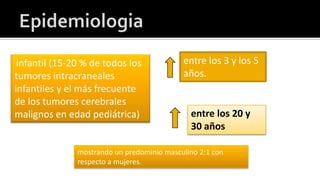 GlioblastomaGlioblastoma multiforme. Tumor infiltrante, hemorrágico, con focos necróticos e infiltración de las comisuras 