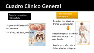 IRMintraoperatorias de paciente conglioblastomamultiforme frontal derecho (GBM) vista en T1 axial. 