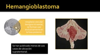 El Dx se hace por RMDiagnóstico