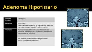 El Dx se hace por RMsuelen tener calcificaciones, necrosis central y ser más heterogéneos con tendencia al crecimiento dentro del ventrículo.Diagnóstico