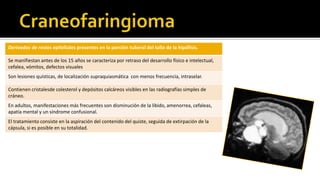 MeningiomaIRM sagital muestra   meningioma de silla que causa compresión del quiasma óptico.Aunque aparece similar a un macroadenoma pituitario, la presencia de una silla turca normal  (flecha) indica un origen suprasillar y hace del meningioma un diagnostico más probable.Imagen de ResonanciaMagnetica Coronal mostrando un meningioma en la fosa media que se extiendehacia el senocavernoso. Obtenidadespues de la administracion de Gadolinio. Pese al tamaño del tumor, no encontramos edema suprayacente