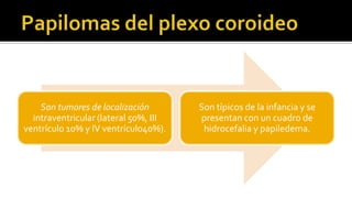 Adenoma Hipofisiario