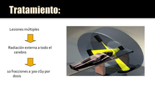 Menos del 2%. Su incidencia es elevada en pacientes inmunodeprimidos, trasplantados renales y cardíacos, ataxia-telangiectasia. son de grado alto o intermedio de malignidad, de distribución perivascular y con marcadores de superficie que los relacionan con los linfocitos tipo B.se presenta como una o varias masas supratentoriales que captan contraste de forma homogénea en la tomografía computarizada(TC). Al inicio no presenta diseminación sistémica, pero el 10 y el 26% presentan después diseminación en el LCR, Supervivencia media de alrededor de 12 meses.El tratamiento con radioterapia suele controlar el tumor, pero la mayoría de los pacientes fallecen ante de 6 meses a causa de infecciones intercurrentes.Linfoma cerebral primario