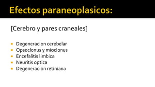     Etiología:Tumor primario:Mama                              [20%]Pulmón                            [13%]Linfoma                           [11%]Próstata                            [9%]Sarcoma                           [9%]Riñón                                [7%]Cabeza y cuello               [6%]Mieloma                           [4%]Gastrointestinal                [4%]Melanoma                        [3%]Nota:Región anatómica mas afectada:Columna dorsal15%68%16%