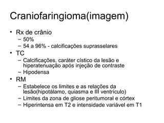 Craniofaringioma(imagem) 
• Rx de crânio 
– 50% 
– 54 a 96% - calcificações suprasselares 
• TC 
– Calcificações, caráter cístico da lesão e 
hiperatenuação após injeção de contraste 
– Hipodensa 
• RM 
– Estabelece os limites e as relações da 
lesão(hipotálamo, quiasma e III ventrículo) 
– Limites da zona de gliose peritumoral e córtex 
– Hiperintensa em T2 e intensidade variável em T1 
 