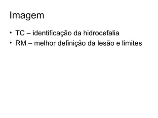 Imagem 
• TC – identificação da hidrocefalia 
• RM – melhor definição da lesão e limites 
 