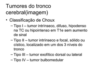 Tumores do tronco 
cerebral(imagem) 
• Classificação de Choux 
– Tipo I – tumor intrínseco, difuso, hipodenso 
na TC ou hipointenso em T1e sem aumento 
de sinal 
– Tipo II – tumor intrínseco e focal, sólido ou 
cístico, localizado em um dos 3 níveis do 
tronco 
– Tipo III – tumor exofítico dorsal ou lateral 
– Tipo IV – tumor bulbomedular 
 